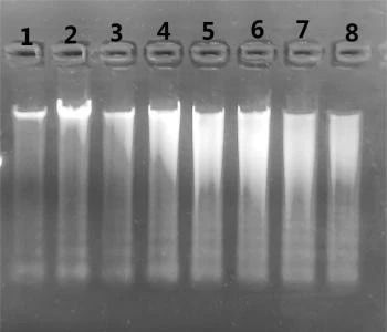 在1%的琼脂糖凝胶上加入5 μl洗脱的唾液DNA进行电泳结果