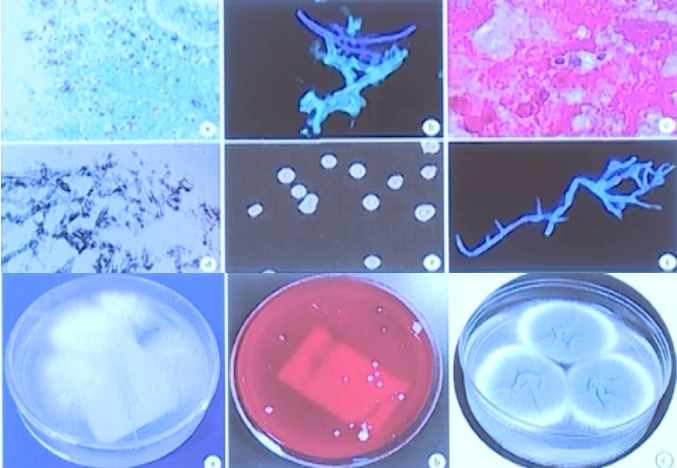 微生物培养可以分离的常见病原体.jpg